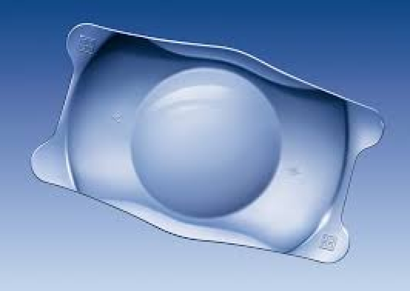 Miopia: il trend delle lenti intraoculari (ICL) per liberarsi di occhiali e lenti a contatto